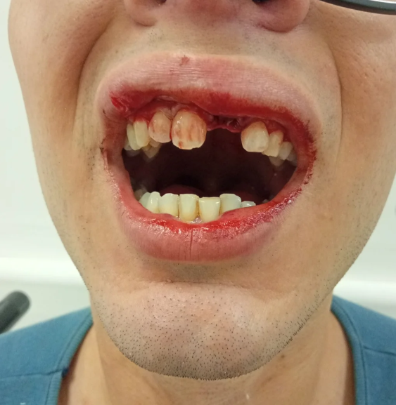 Solidaridad con La queen: Ataque homofóbico en CABA